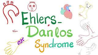 Ehlers-Danlos Syndrome - Causes, Symptoms, Diagnosis, and Treatment - Biochemistry & Genetics