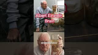 Controversy Over Einstein's Brain #shorts #einstein