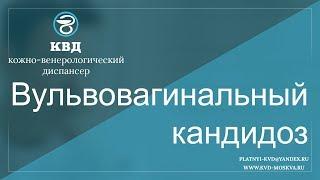 514  Вульвовагинальный кандидоз