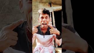 How I Cured a Bug Bite with Yogurt in the Wild#funny #comedy 