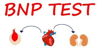 Brain Natriuretic Peptide (BNP) Test for heart failure