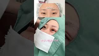 【二重埋没】リアルな反応#shorts