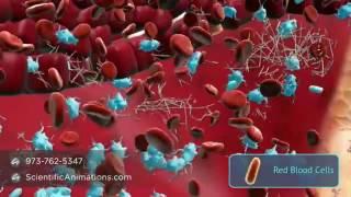 Angiogenesis   Formation of new blood vessels