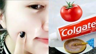 Mix tomato and toothpaste!  A mask to whiten the skin and look younger!