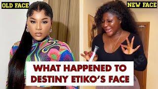 Why Destiny Etiko Change Her Face, New Face Reconstruction Surgery, The Hidden Reason Why