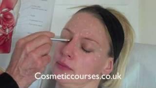 Botox training 2:  Where to place Botox injections