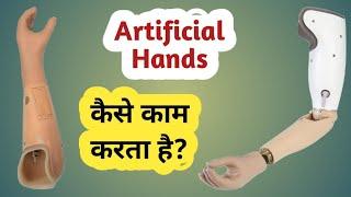 Types of High Technology Artificial  Hand and Its Features #myoelectric Hand #Bionic Hand