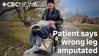 Review underway after patient says wrong leg amputated at Winnipeg hospital