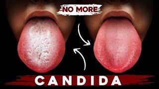 A Better Way to Eliminate Candida for Good