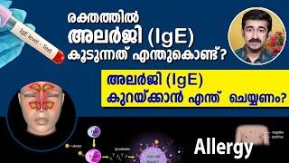 രക്തത്തിൽ അലർജി (IgE) കൂടുന്നത് എന്തുകൊണ്ട് ?അലർജി (IgE) കുറയ്ക്കാൻ എന്ത് ചെയ്യണം ? Imp. Information