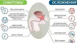 Простатит, илтихоби гадуди простата.