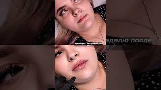 #fillerlips #krsk