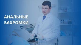 Анальные бахромки