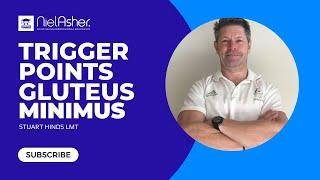 Treating Trigger Points - Gluteus Minimus