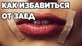 ЛЕЧЕНИЕ ЗАЕДЫ ТРЕЩИНКИ В УГОЛКАХ РТА В КАЖДОЙ АПТЕКЕ ПРОСТОЕ СРЕДСТВО@obovsemsmarusya