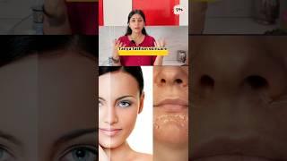 Dr. Upasana DIY Pack for Glowing & Whitening Skin | Instant Home Remedy! Instant Korean glass skin!