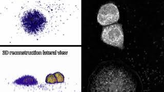 Label-free live cell imaging of antigen mediated mast cell degranulation