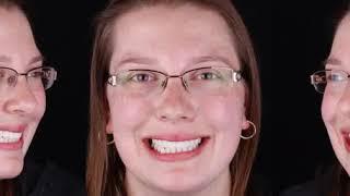 Dr. Beenish Orr (1).avi