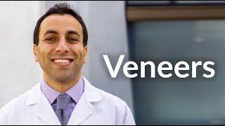 Veneers - Dr. Tamer Azim, DDS - San Francisco Dentist