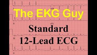 EKG/ECG Standard 12-Lead ECG - Question 6.0 l The EKG Guy