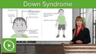 Down Syndrome – Genetics | Lecturio