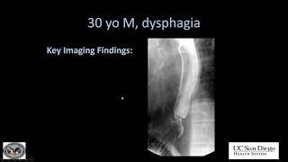 Imaging of esophagus