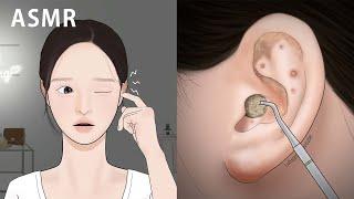 ASMR Ear cleaning Animation! Satisfying pimple popping / LULUPANG