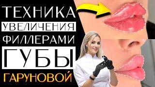 Техника увеличения филлерами Губы Гаруновой