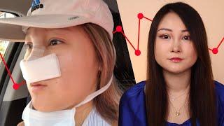 I Got Plastic Surgery And I Regret It | This Is That Story | BuzzFeed Video