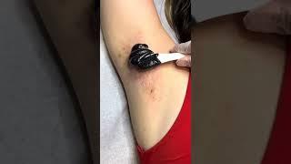 under arms waxing #bodywax #brazillianwax #hairremoval #viralvideo