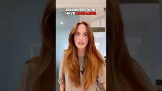 Celebrities Who Have Lookalikes 