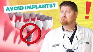 The Top Reasons You Should NOT Get Dental Implants