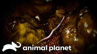 A Young Teenager Vomiting Fecal Matter | Monsters Inside Me | Animal Planet