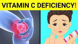 15 Signs And Symptoms Of Vitamin C Deficiency | ( Vitamin C Deficiency )