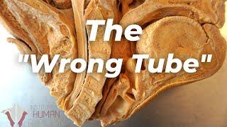 How BAD Is It When Something Goes Down the "Wrong Tube"???