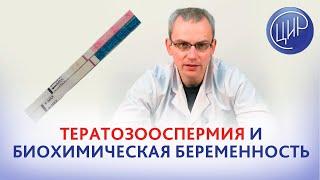 Тератозооспермия и биохимическая беременность. Есть ли связь? Андролог ЦИР, к.м.н., Живулько А.Р.