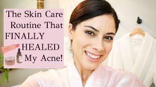 MY SKINCARE ROUTINE FOR ACNE PRONE SKIN | How I Am Leveling Up My Skin and Skincare Routine