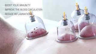 Hijama/Cupping Therapy, How many cups should I use?