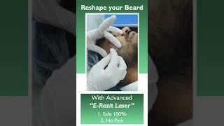 Laser for beard reshaping | facial hair removal skin care | laser treatments for face