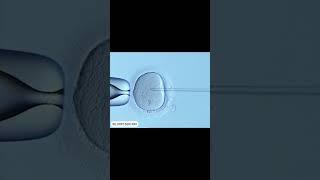 Egg-xact Match: ICSI vs. Conventional Insemination Explained!