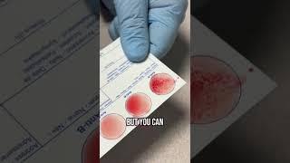 What do blood types look like?