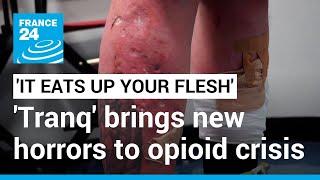 'It eats up your flesh': 'Tranq', the new drug worsening America's opioid epidemic • FRANCE 24