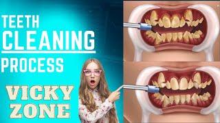 ViCky ZoNe Satisfying symbios socket preservation | Teeth cavity treatment animation