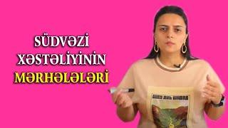 Südvəzi Xəstəliyinin Mərhələləri - BUNU VACİB BİLMƏLİSİZ