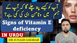 Signs of Vitamin E Deficiency | Vitamin of Youth | Dr Junaid Asghar