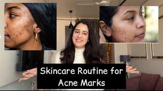 Skincare Routine for acne marks | Acne marks removal routine under rs 500 | skincare | pimple marks