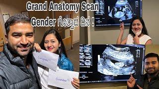 Gender ಗೊತ್ತಾದ ದಿನ | ANATOMY SCAN | ನಿಮ್ಮ ಮುಂದೆ ನಮ್ಮ ಸಿಹಿ ಕ್ಷಣಗಳು !! ಯಾವ ಮಗು ಇರಬಹುದು guess ಮಾಡಿ??