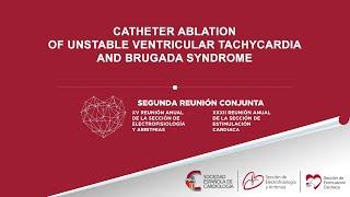 Catheter ablation of unstable ventricular tachycardia and Brugada Syndrome