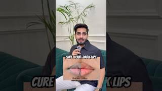  How to Cure Dark Lips | Lip Balm That Brightens & Restores | Dark Lip Solution | Lip Care Hacks.