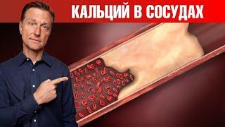 Главная причина кальцификации сосудов‼️ Кальций в сосудах